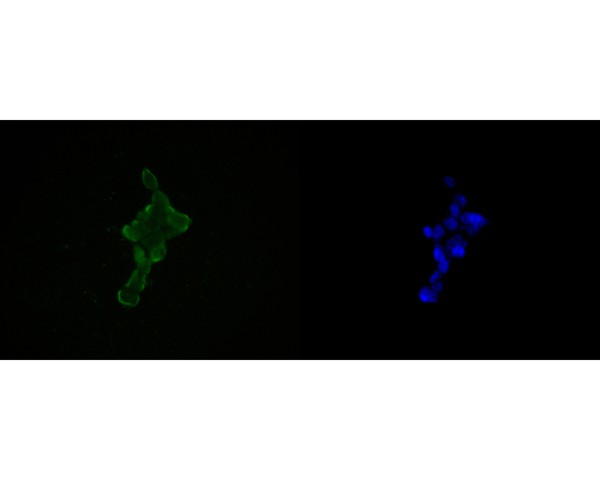 ICC staining of HDGF in F9 cells (green). Formalin fixed cells were permeabilized with 0.1% Triton X-100 in TBS for 10 minutes at room temperature and blocked with 1% Blocker BSA for 15 minutes at room temperature. Cells were probed with the primary antibody (ET7111-42, 1/50) for 1 hour at room temperature, washed with PBS. Alexa Fluor®488 Goat anti-Rabbit IgG was used as the secondary antibody at 1/1,000 dilution. The nuclear counter stain is DAPI (blue).