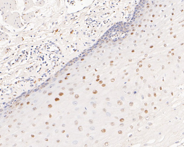Immunohistochemical analysis of paraffin-embedded human esophagus tissue using anti-HDGF antibody. The section was pre-treated using heat mediated antigen retrieval with sodium citrate buffer (pH 6.0) for 20 minutes. The tissues were blocked in 5% BSA for 30 minutes at room temperature, washed with ddH2O and PBS, and then probed with the primary antibody (ET7111-42, 1/200)  for 30 minutes at room temperature. The detection was performed using an HRP conjugated compact polymer system. DAB was used as the chromogen. Tissues were counterstained with hematoxylin and mounted with DPX.
