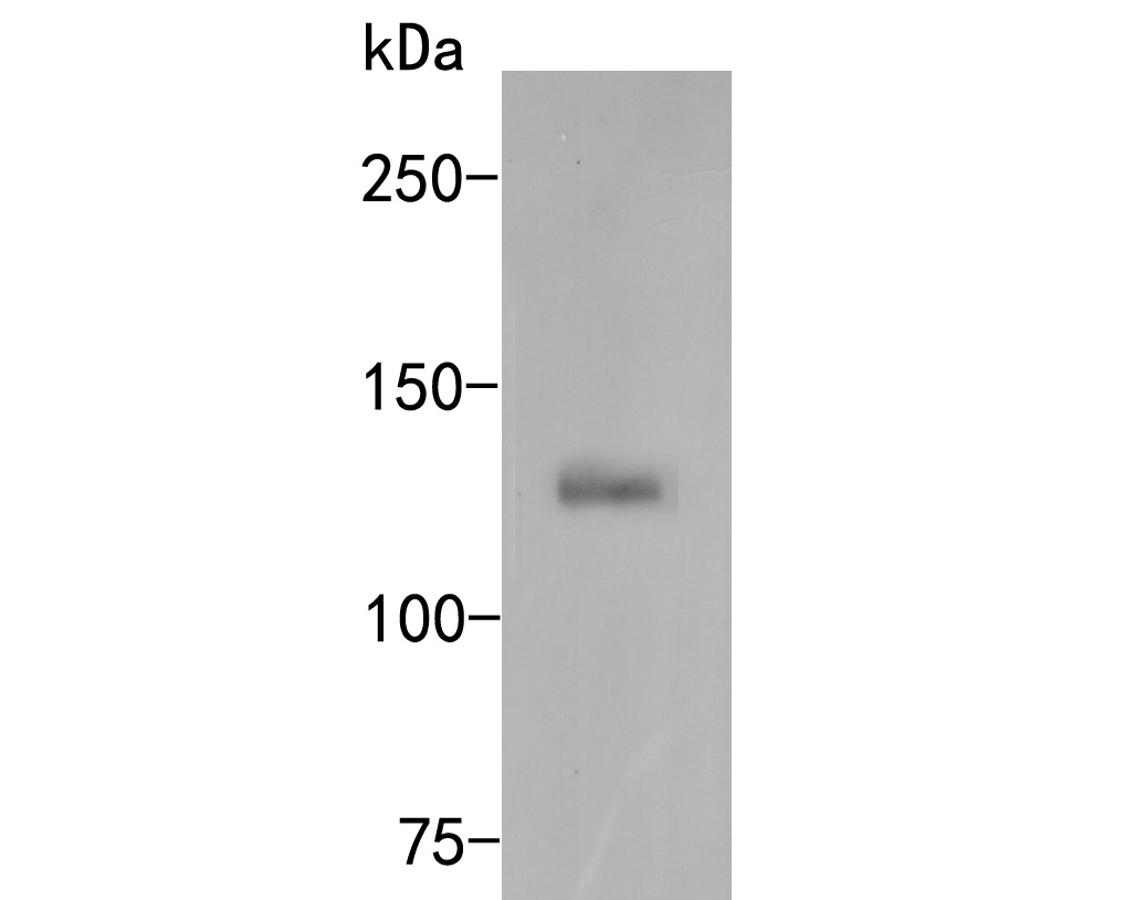 Western blot analysis of CD133 on human stomach tissue lysates. Proteins were transferred to a PVDF membrane and blocked with 5% BSA in PBS for 1 hour at room temperature. The primary antibody (ER1901-63, 1/500) was used in 5% BSA at room temperature for 2 hours. Goat Anti-Rabbit IgG - HRP Secondary Antibody (HA1001) at 1:5,000 dilution was used for 1 hour at room temperature.