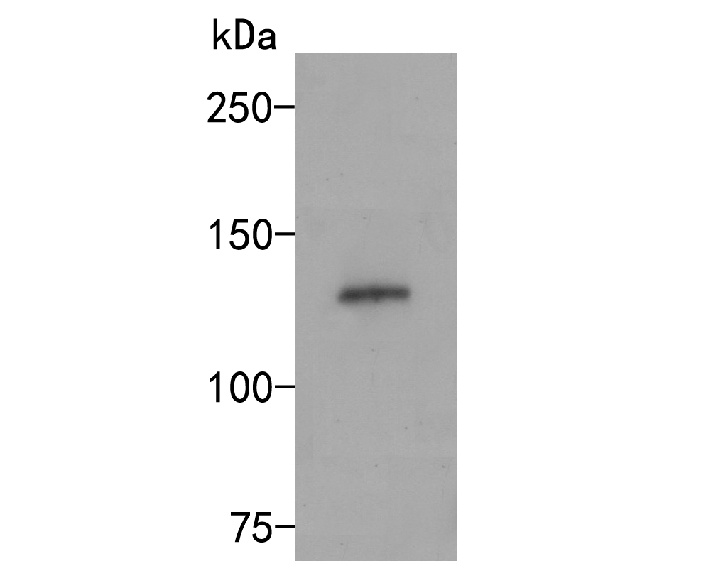 Western blot analysis of CD133 on PC-12 cell lysates. Proteins were transferred to a PVDF membrane and blocked with 5% BSA in PBS for 1 hour at room temperature. The primary antibody (ER1901-63, 1/500) was used in 5% BSA at room temperature for 2 hours. Goat Anti-Rabbit IgG - HRP Secondary Antibody (HA1001) at 1:5,000 dilution was used for 1 hour at room temperature.
