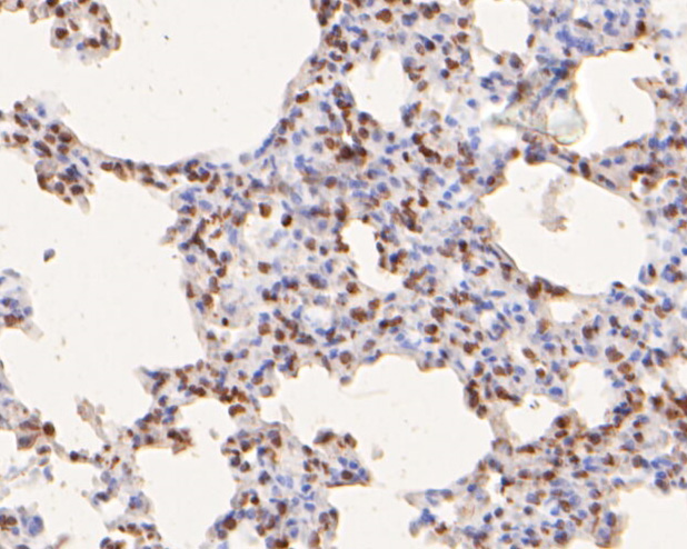 Immunohistochemical analysis of paraffin-embedded rat lung tissue using anti-hNaa50p antibody. The section was pre-treated using heat mediated antigen retrieval with sodium citrate buffer (pH 6.0) for 20 minutes. The tissues were blocked in 5% BSA for 30 minutes at room temperature, washed with ddH2O and PBS, and then probed with the primary antibody (HA500001, 1/400)  for 30 minutes at room temperature. The detection was performed using an HRP conjugated compact polymer system. DAB was used as the chromogen. Tissues were counterstained with hematoxylin and mounted with DPX.