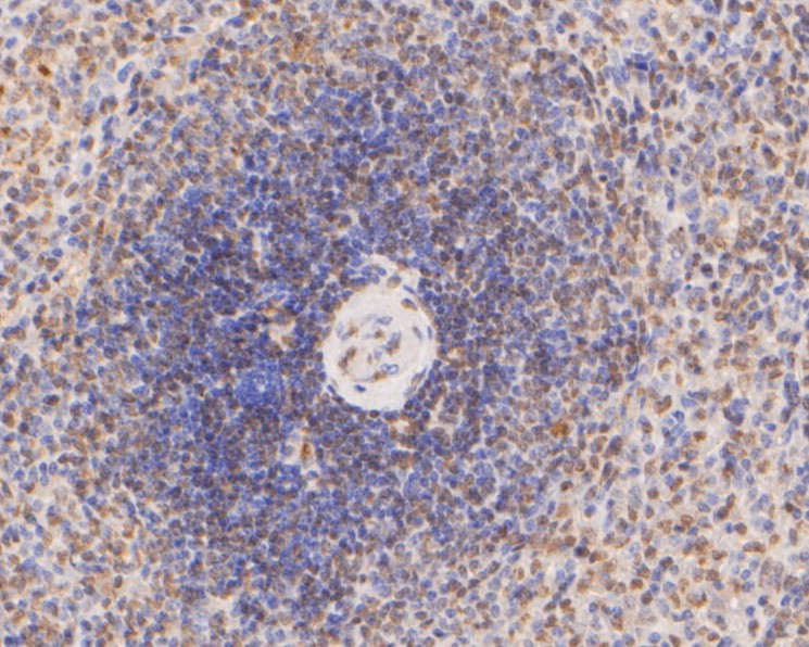 Immunohistochemical analysis of paraffin-embedded human spleen tissue using anti-hNaa50p antibody. The section was pre-treated using heat mediated antigen retrieval with sodium citrate buffer (pH 6.0) for 20 minutes. The tissues were blocked in 5% BSA for 30 minutes at room temperature, washed with ddH2O and PBS, and then probed with the primary antibody (HA500001, 1/200)  for 30 minutes at room temperature. The detection was performed using an HRP conjugated compact polymer system. DAB was used as the chromogen. Tissues were counterstained with hematoxylin and mounted with DPX.