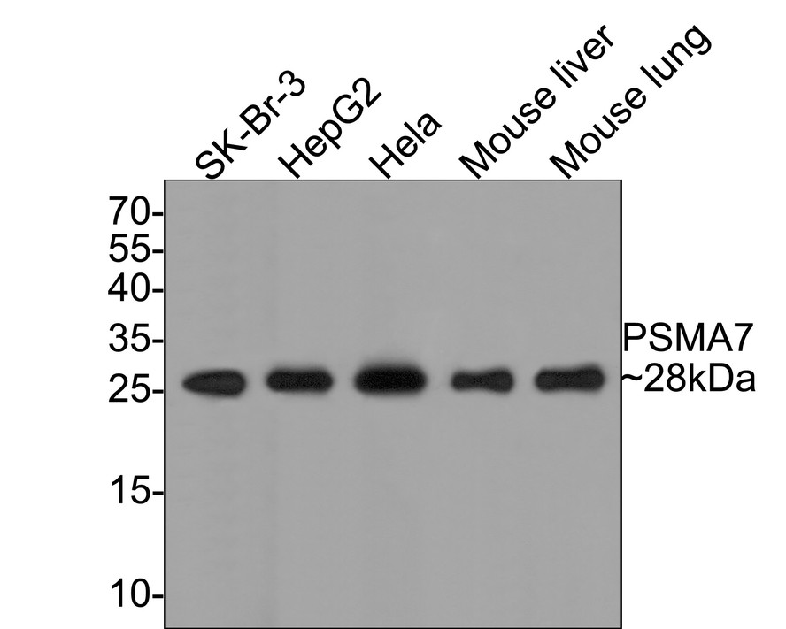 Western blot analysis of PSMA7 on different lysates. Proteins were transferred to a PVDF membrane and blocked with 5% BSA in PBS for 1 hour at room temperature. The primary antibody (HA500004, 1/500) was used in 5% BSA at room temperature for 2 hours. Goat Anti-Rabbit IgG - HRP Secondary Antibody (HA1001) at 1:5,000 dilution was used for 1 hour at room temperature.<br />
Positive control: <br />
Lane 1: SKBR-3 cell lysate<br />
Lane 2: HepG2 cell lysate<br />
Lane 3: Hela cell lysate<br />
Lane 4: Mouse liver tissue lysate<br />
Lane 5: Mouse lung tissue lysate