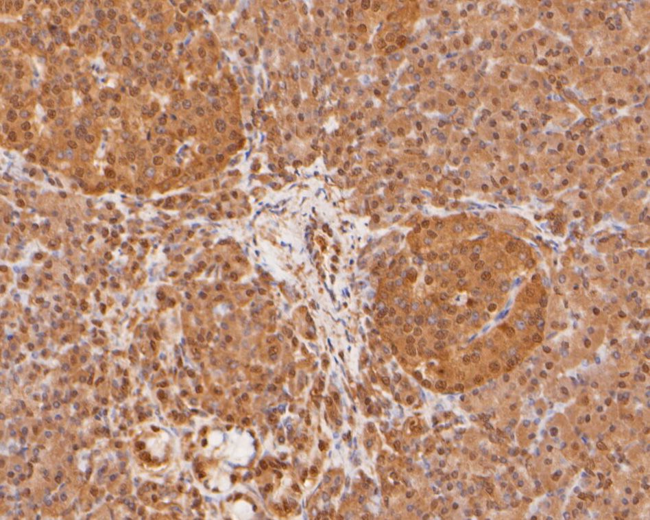 Immunohistochemical analysis of paraffin-embedded human pancreas tissue using anti-PSMA7 antibody. The section was pre-treated using heat mediated antigen retrieval with sodium citrate buffer (pH 6.0) for 20 minutes. The tissues were blocked in 5% BSA for 30 minutes at room temperature, washed with ddH2O and PBS, and then probed with the primary antibody (HA500004, 1/400)  for 30 minutes at room temperature. The detection was performed using an HRP conjugated compact polymer system. DAB was used as the chromogen. Tissues were counterstained with hematoxylin and mounted with DPX.