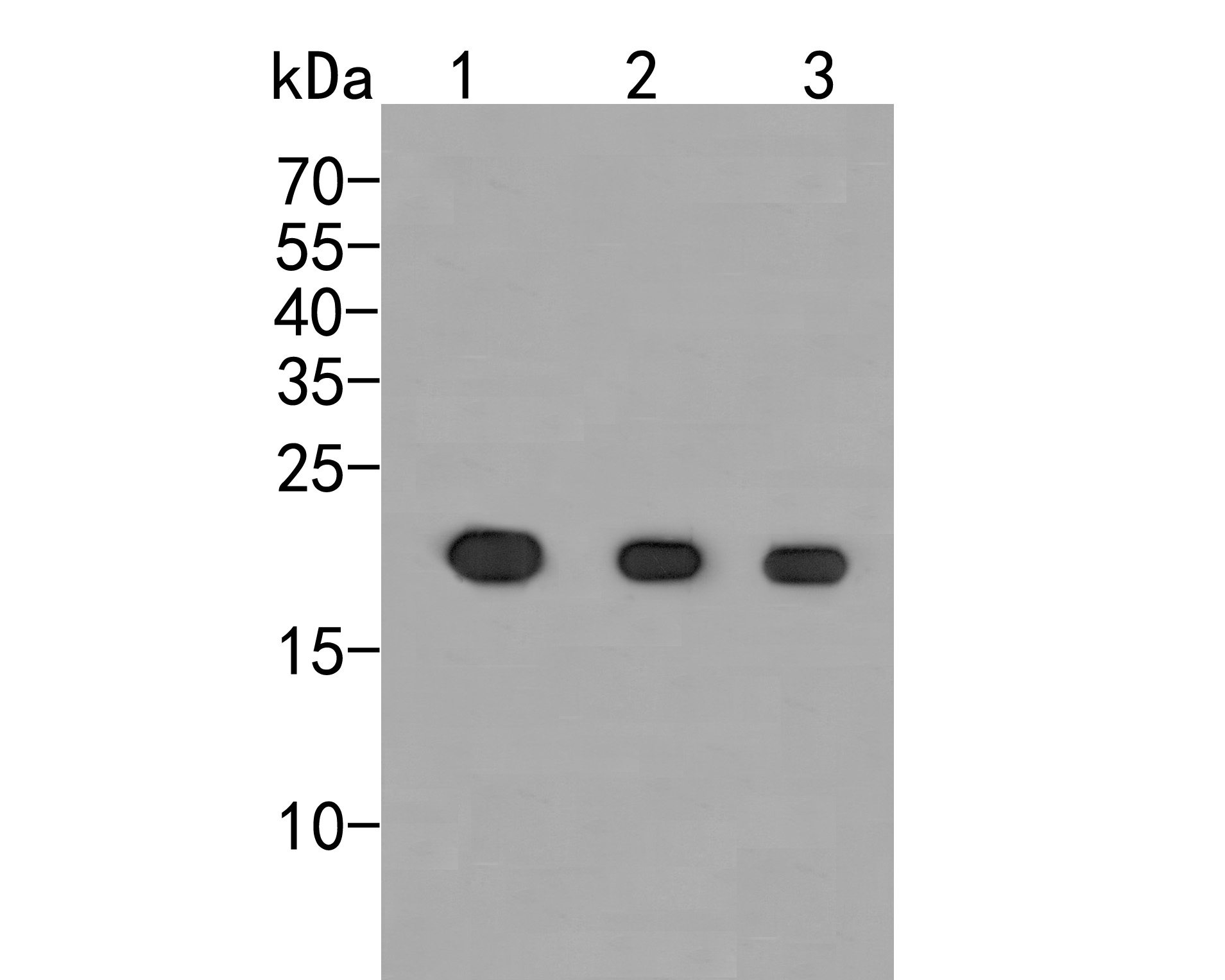Western blot analysis of p21 ARC on different lysates. Proteins were transferred to a PVDF membrane and blocked with 5% BSA in PBS for 1 hour at room temperature. The primary antibody (HA500005, 1/500) was used in 5% BSA at room temperature for 2 hours. Goat Anti-Rabbit IgG - HRP Secondary Antibody (HA1001) at 1:5,000 dilution was used for 1 hour at room temperature.<br />
Positive control: <br />
Lane 1: THP-1 cell lysate <br />
Lane 2: Rat lung tissue lysate<br />
Lane 3: Mouse lung tissue lysate