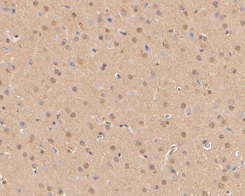 Immunohistochemical analysis of paraffin-embedded rat brain tissue using anti-p21 ARC antibody. The section was pre-treated using heat mediated antigen retrieval with Tris-EDTA buffer (pH 8.0-8.4) for 20 minutes.The tissues were blocked in 5% BSA for 30 minutes at room temperature, washed with ddH2O and PBS, and then probed with the primary antibody (HA500005, 1/50) for 30 minutes at room temperature. The detection was performed using an HRP conjugated compact polymer system. DAB was used as the chromogen. Tissues were counterstained with hematoxylin and mounted with DPX.