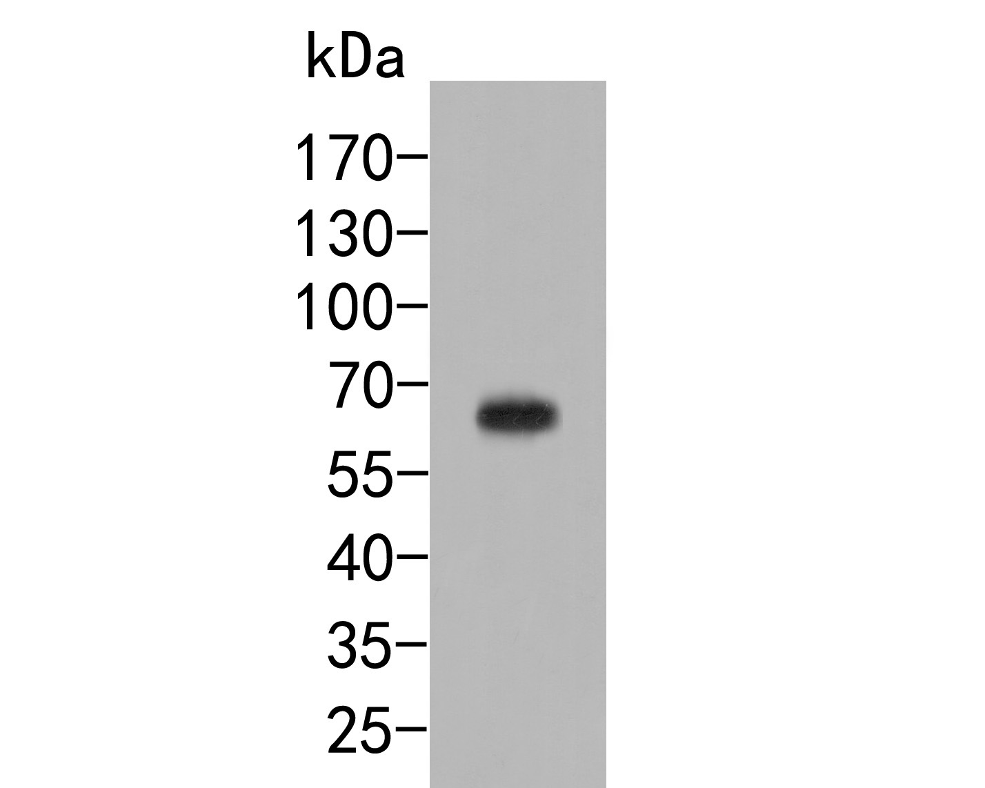 Western blot analysis of Dopamine Transporter on mouse brian tissue lysates. Proteins were transferred to a PVDF membrane and blocked with 5% BSA in PBS for 1 hour at room temperature. The primary antibody (HA500007, 1/500) was used in 5% BSA at room temperature for 2 hours. Goat Anti-Rabbit IgG - HRP Secondary Antibody (HA1001) at 1:5,000 dilution was used for 1 hour at room temperature.