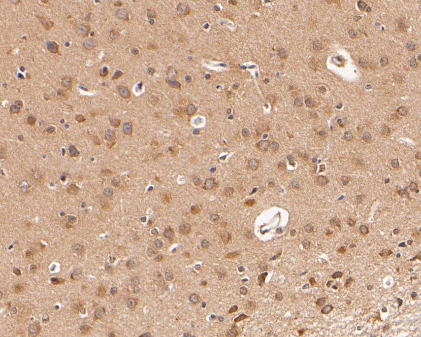 Immunohistochemical analysis of paraffin-embedded rat brain tissue using anti-Dopamine Transporter antibody. The section was pre-treated using heat mediated antigen retrieval with Tris-EDTA buffer (pH 8.0-8.4) for 20 minutes.The tissues were blocked in 5% BSA for 30 minutes at room temperature, washed with ddH2O and PBS, and then probed with the primary antibody (HA500007, 1/400) for 30 minutes at room temperature. The detection was performed using an HRP conjugated compact polymer system. DAB was used as the chromogen. Tissues were counterstained with hematoxylin and mounted with DPX.