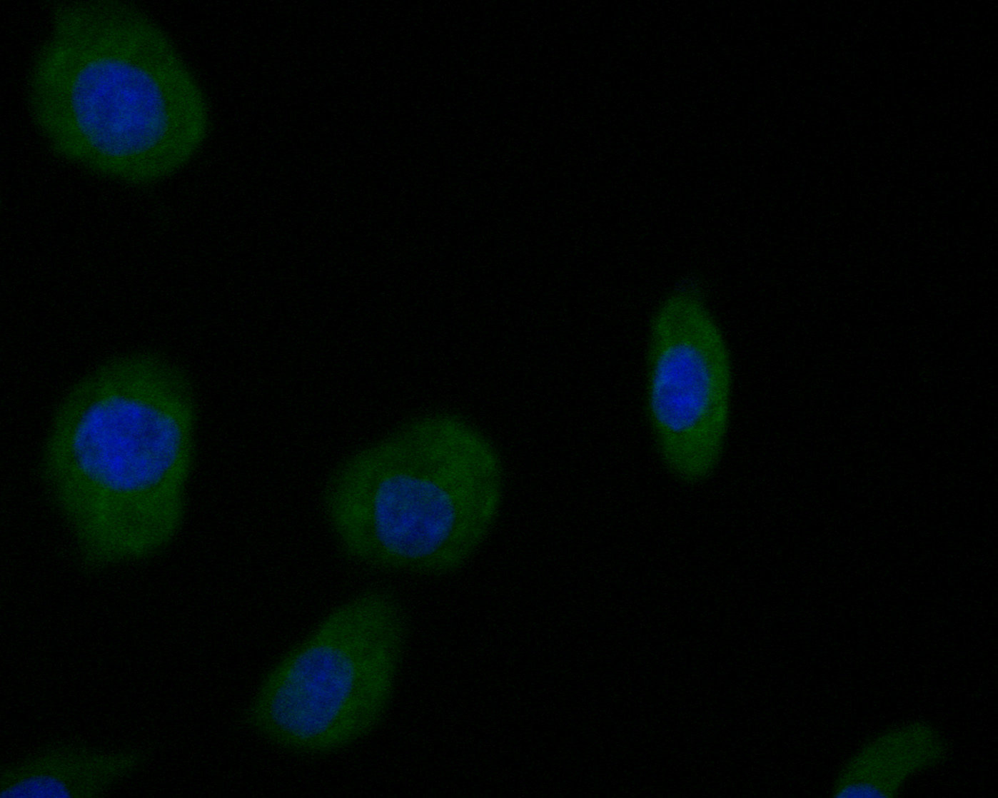 ICC staining of Dopamine Transporter in SKOV-3 cells (green). Formalin fixed cells were permeabilized with 0.1% Triton X-100 in TBS for 10 minutes at room temperature and blocked with 1% Blocker BSA for 15 minutes at room temperature. Cells were probed with the primary antibody (HA500007, 1/200) for 1 hour at room temperature, washed with PBS. Alexa Fluor®488 Goat anti-Rabbit IgG was used as the secondary antibody at 1/1,000 dilution. The nuclear counter stain is DAPI (blue).