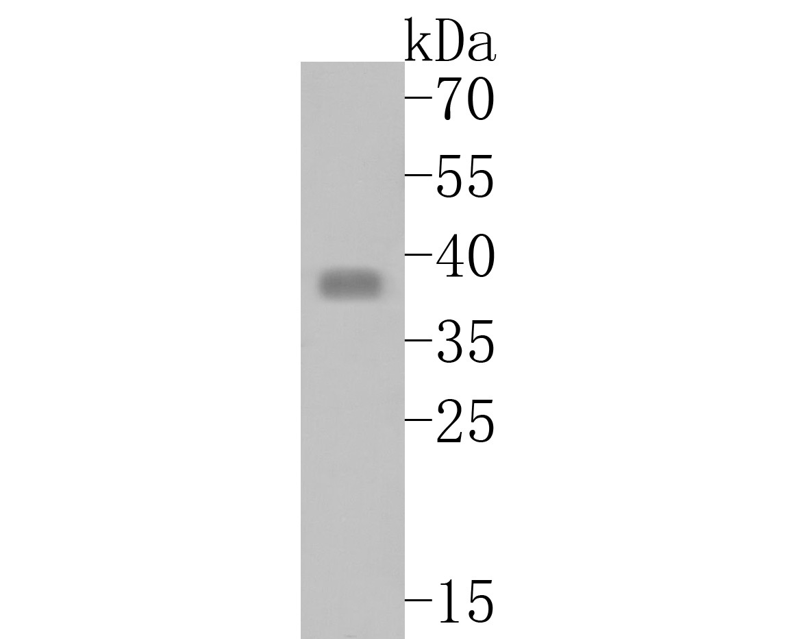 Western blot analysis of TMX4 on rat skin tissue lysates. Proteins were transferred to a PVDF membrane and blocked with 5% BSA in PBS for 1 hour at room temperature. The primary antibody (HA500009, 1/500) was used in 5% BSA at room temperature for 2 hours. Goat Anti-Rabbit IgG - HRP Secondary Antibody (HA1001) at 1:5,000 dilution was used for 1 hour at room temperature.