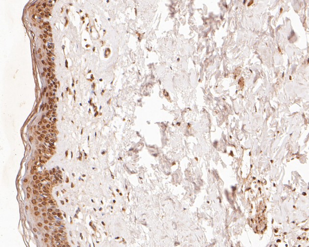 Immunohistochemical analysis of paraffin-embedded human skin tissue using anti-TMX4 antibody. The section was pre-treated using heat mediated antigen retrieval with sodium citrate buffer (pH 6.0) for 20 minutes. The tissues were blocked in 5% BSA for 30 minutes at room temperature, washed with ddH2O and PBS, and then probed with the primary antibody (HA500009, 1/400)  for 30 minutes at room temperature. The detection was performed using an HRP conjugated compact polymer system. DAB was used as the chromogen. Tissues were counterstained with hematoxylin and mounted with DPX.