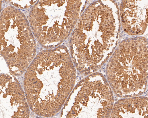 Immunohistochemical analysis of paraffin-embedded mouse testis tissue using anti-TMX4 antibody. The section was pre-treated using heat mediated antigen retrieval with sodium citrate buffer (pH 6.0) for 20 minutes. The tissues were blocked in 5% BSA for 30 minutes at room temperature, washed with ddH2O and PBS, and then probed with the primary antibody (HA500009, 1/400)  for 30 minutes at room temperature. The detection was performed using an HRP conjugated compact polymer system. DAB was used as the chromogen. Tissues were counterstained with hematoxylin and mounted with DPX.