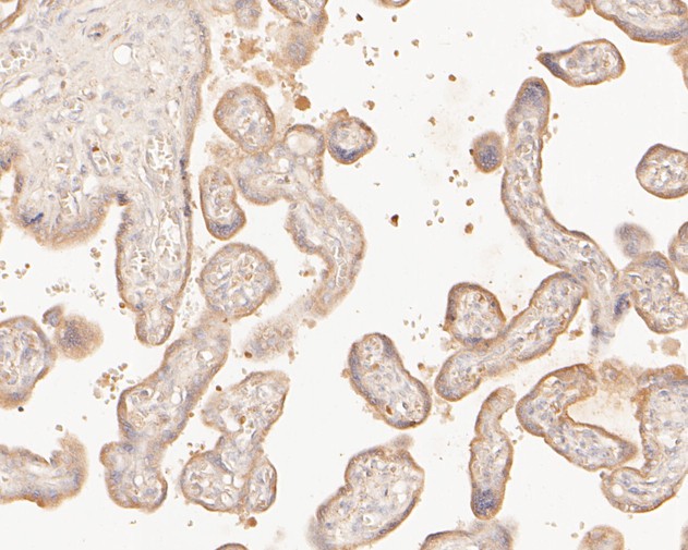 Immunohistochemical analysis of paraffin-embedded human placenta tissue using anti-LSS antibody. The section was pre-treated using heat mediated antigen retrieval with Tris-EDTA buffer (pH 8.0-8.4) for 20 minutes.The tissues were blocked in 5% BSA for 30 minutes at room temperature, washed with ddH2O and PBS, and then probed with the primary antibody (HA500011, 1/400) for 30 minutes at room temperature. The detection was performed using an HRP conjugated compact polymer system. DAB was used as the chromogen. Tissues were counterstained with hematoxylin and mounted with DPX.