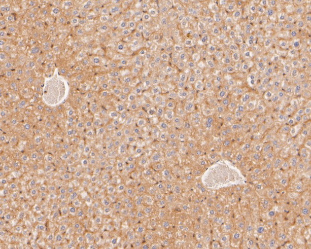 Immunohistochemical analysis of paraffin-embedded mouse liver tissue using anti-LSS antibody. The section was pre-treated using heat mediated antigen retrieval with Tris-EDTA buffer (pH 8.0-8.4) for 20 minutes.The tissues were blocked in 5% BSA for 30 minutes at room temperature, washed with ddH2O and PBS, and then probed with the primary antibody (HA500011, 1/400) for 30 minutes at room temperature. The detection was performed using an HRP conjugated compact polymer system. DAB was used as the chromogen. Tissues were counterstained with hematoxylin and mounted with DPX.