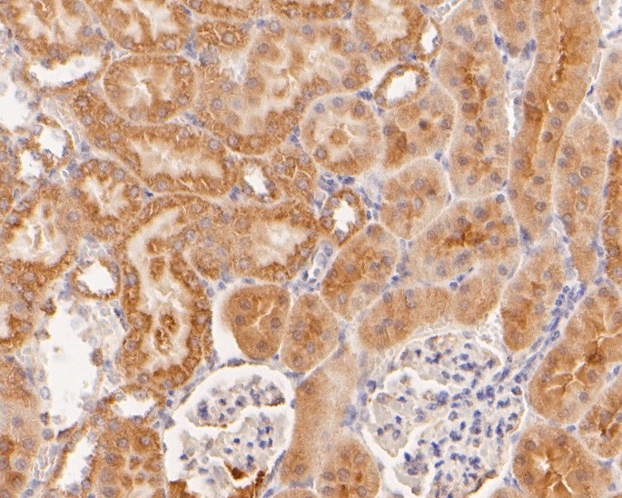 Immunohistochemical analysis of paraffin-embedded rat kidney tissue using anti-HPD antibody. The section was pre-treated using heat mediated antigen retrieval with sodium citrate buffer (pH 6.0) for 20 minutes. The tissues were blocked in 5% BSA for 30 minutes at room temperature, washed with ddH2O and PBS, and then probed with the primary antibody (HA500012, 1/800)  for 30 minutes at room temperature. The detection was performed using an HRP conjugated compact polymer system. DAB was used as the chromogen. Tissues were counterstained with hematoxylin and mounted with DPX.