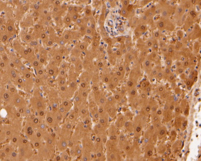 Immunohistochemical analysis of paraffin-embedded human liver tissue using anti-HPD antibody. The section was pre-treated using heat mediated antigen retrieval with sodium citrate buffer (pH 6.0) for 20 minutes. The tissues were blocked in 5% BSA for 30 minutes at room temperature, washed with ddH2O and PBS, and then probed with the primary antibody (HA500012, 1/800)  for 30 minutes at room temperature. The detection was performed using an HRP conjugated compact polymer system. DAB was used as the chromogen. Tissues were counterstained with hematoxylin and mounted with DPX.
