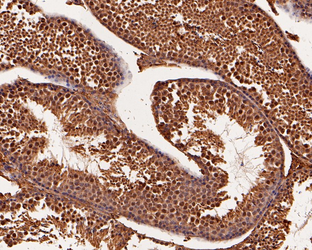 Immunohistochemical analysis of paraffin-embedded mouse testis tissue using anti-BRCA1 antibody. The section was pre-treated using heat mediated antigen retrieval with sodium citrate buffer (pH 6.0) for 20 minutes. The tissues were blocked in 5% BSA for 30 minutes at room temperature, washed with ddH2O and PBS, and then probed with the primary antibody (HA500015, 1/800)  for 30 minutes at room temperature. The detection was performed using an HRP conjugated compact polymer system. DAB was used as the chromogen. Tissues were counterstained with hematoxylin and mounted with DPX.