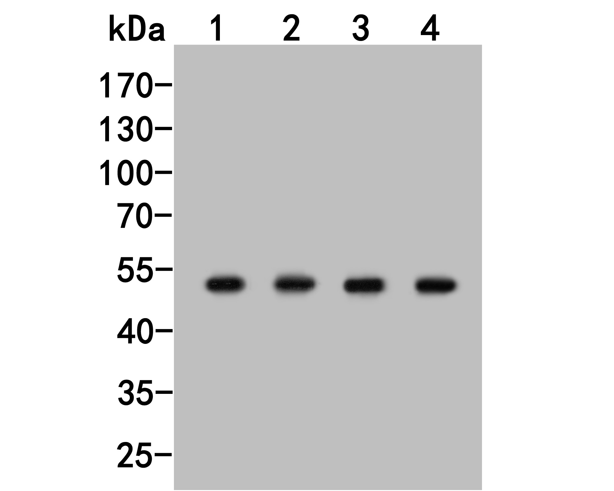 Western blot analysis of TAT on different lysates. Proteins were transferred to a PVDF membrane and blocked with 5% BSA in PBS for 1 hour at room temperature. The primary antibody (HA500016, 1/1,000) was used in 5% BSA at room temperature for 2 hours. Goat Anti-Rabbit IgG - HRP Secondary Antibody (HA1001) at 1:5,000 dilution was used for 1 hour at room temperature.<br />
Positive control: <br />
Lane 1: HL-60 cell lysate<br />
Lane 2: Daudi cell lysate<br />
Lane 3: Mouse kidney tissue lysate<br />
Lane 4: Rat kidney tissue lysate