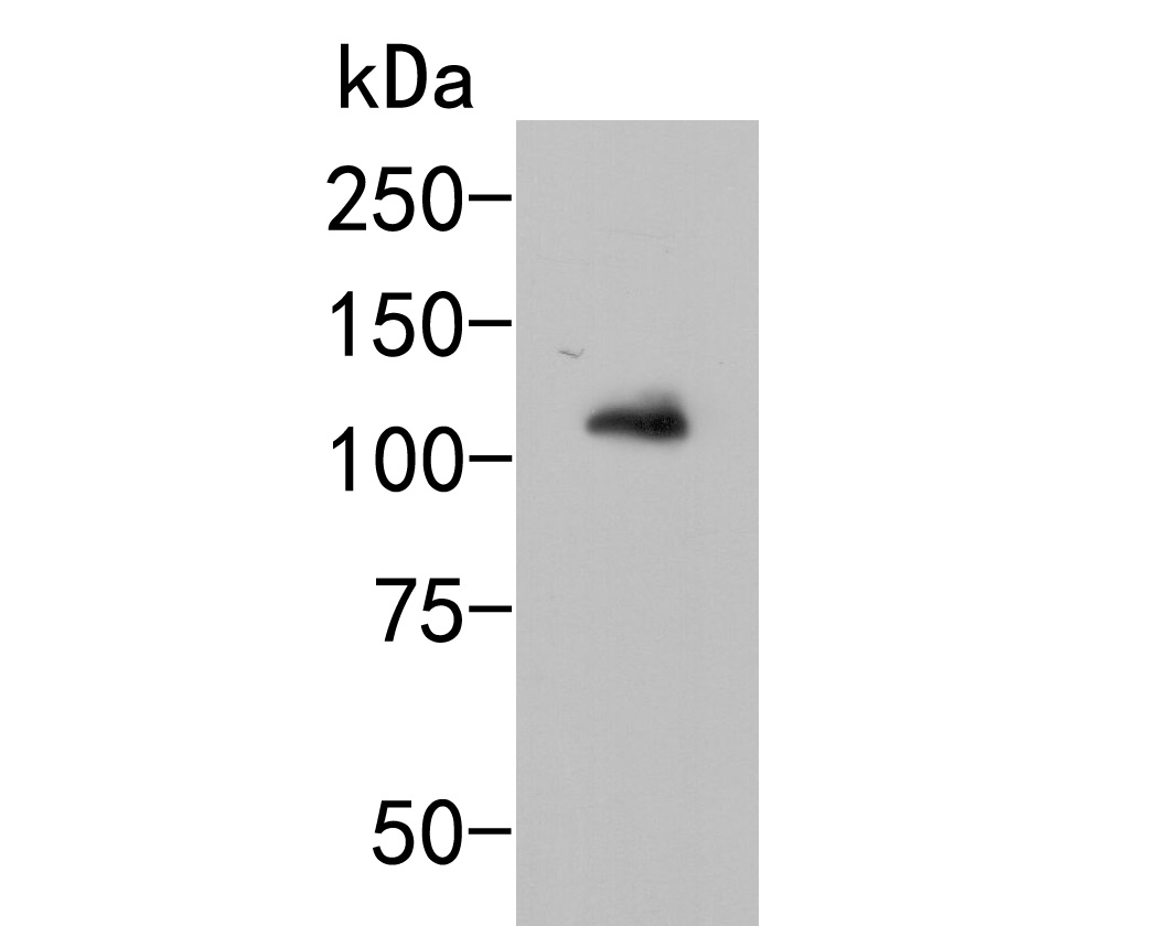 Western blot analysis of GRIK4 on 293 cell lysates. Proteins were transferred to a PVDF membrane and blocked with 5% BSA in PBS for 1 hour at room temperature. The primary antibody (HA500017, 1/500) was used in 5% BSA at room temperature for 2 hours. Goat Anti-Rabbit IgG - HRP Secondary Antibody (HA1001) at 1:5,000 dilution was used for 1 hour at room temperature.