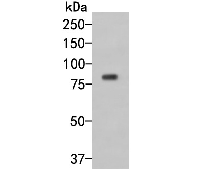 Western blot analysis of GKAP on human brain tissue cell  lysate. Proteins were transferred to a PVDF membrane and blocked with 5% BSA in PBS for 1 hour at room temperature. The primary antibody (HA500018, 1/500) was used in 5% BSA at room temperature for 2 hours. Goat Anti-Rabbit IgG - HRP Secondary Antibody (HA1001) at 1:5,000 dilution was used for 1 hour at room temperature.