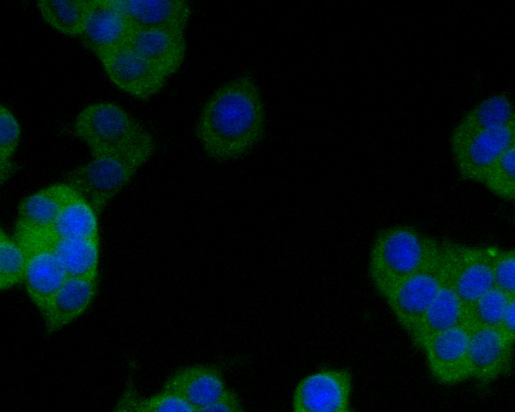 ICC staining of GKAP in PC-12 cells (green). Formalin fixed cells were permeabilized with 0.1% Triton X-100 in TBS for 10 minutes at room temperature and blocked with 1% Blocker BSA for 15 minutes at room temperature. Cells were probed with the primary antibody (HA500018, 1/100) for 1 hour at room temperature, washed with PBS. Alexa Fluor®488 Goat anti-Rabbit IgG was used as the secondary antibody at 1/1,000 dilution. The nuclear counter stain is DAPI (blue).