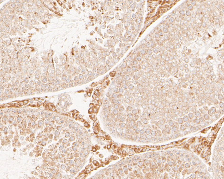 Immunohistochemical analysis of paraffin-embedded rat testis tissue using anti-GKAP antibody. The section was pre-treated using heat mediated antigen retrieval with Tris-EDTA buffer (pH 8.0-8.4) for 20 minutes.The tissues were blocked in 5% BSA for 30 minutes at room temperature, washed with ddH2O and PBS, and then probed with the primary antibody (HA500018, 1/200) for 30 minutes at room temperature. The detection was performed using an HRP conjugated compact polymer system. DAB was used as the chromogen. Tissues were counterstained with hematoxylin and mounted with DPX.