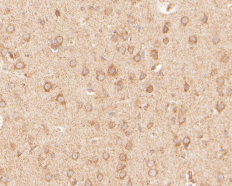 Immunohistochemical analysis of paraffin-embedded rat brain tissue using anti-GKAP antibody. The section was pre-treated using heat mediated antigen retrieval with Tris-EDTA buffer (pH 8.0-8.4) for 20 minutes.The tissues were blocked in 5% BSA for 30 minutes at room temperature, washed with ddH2O and PBS, and then probed with the primary antibody (HA500018, 1/200) for 30 minutes at room temperature. The detection was performed using an HRP conjugated compact polymer system. DAB was used as the chromogen. Tissues were counterstained with hematoxylin and mounted with DPX.