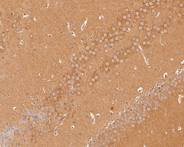 Immunohistochemical analysis of paraffin-embedded mouse brain tissue using anti-GKAP antibody. The section was pre-treated using heat mediated antigen retrieval with Tris-EDTA buffer (pH 8.0-8.4) for 20 minutes.The tissues were blocked in 5% BSA for 30 minutes at room temperature, washed with ddH2O and PBS, and then probed with the primary antibody (HA500018, 1/50) for 30 minutes at room temperature. The detection was performed using an HRP conjugated compact polymer system. DAB was used as the chromogen. Tissues were counterstained with hematoxylin and mounted with DPX.