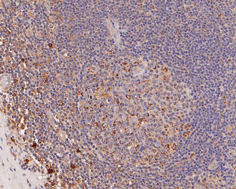 Immunohistochemical analysis of paraffin-embedded human tonsil tissue using anti-ME2 antibody. The section was pre-treated using heat mediated antigen retrieval with Tris-EDTA buffer (pH 8.0-8.4) for 20 minutes.The tissues were blocked in 5% BSA for 30 minutes at room temperature, washed with ddH2O and PBS, and then probed with the primary antibody (HA500022, 1/200) for 30 minutes at room temperature. The detection was performed using an HRP conjugated compact polymer system. DAB was used as the chromogen. Tissues were counterstained with hematoxylin and mounted with DPX.