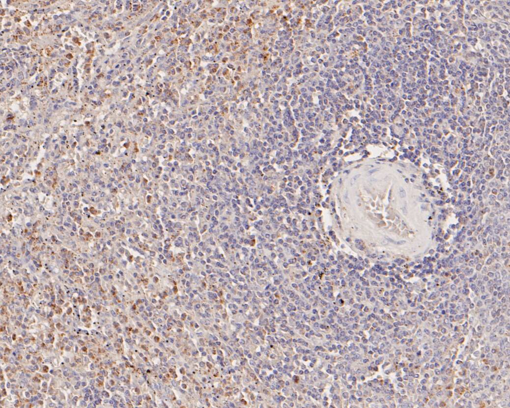 Immunohistochemical analysis of paraffin-embedded human spleen tissue using anti-ME2 antibody. The section was pre-treated using heat mediated antigen retrieval with Tris-EDTA buffer (pH 8.0-8.4) for 20 minutes.The tissues were blocked in 5% BSA for 30 minutes at room temperature, washed with ddH2O and PBS, and then probed with the primary antibody (HA500022, 1/200) for 30 minutes at room temperature. The detection was performed using an HRP conjugated compact polymer system. DAB was used as the chromogen. Tissues were counterstained with hematoxylin and mounted with DPX.