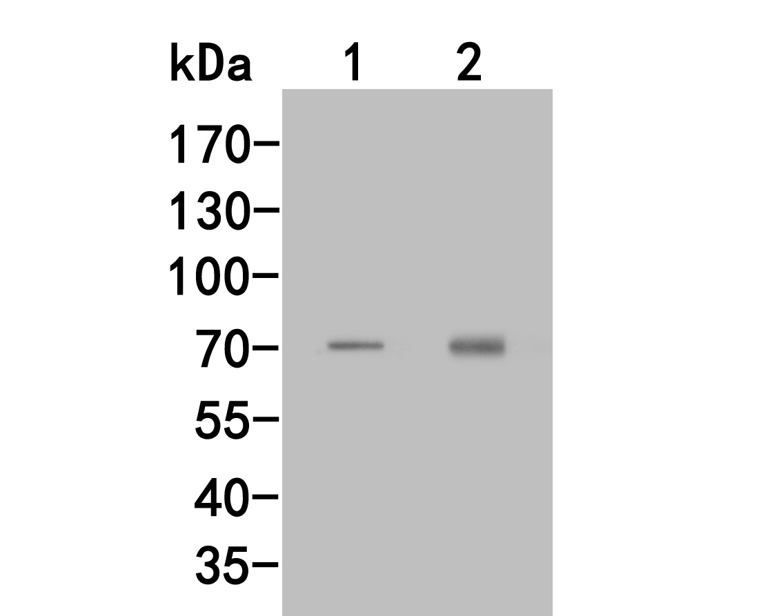 Western blot analysis of RARS on different lysates. Proteins were transferred to a PVDF membrane and blocked with 5% BSA in PBS for 1 hour at room temperature. The primary antibody (HA500027, 1/500) was used in 5% BSA at room temperature for 2 hours. Goat Anti-Rabbit IgG - HRP Secondary Antibody (HA1001) at 1:5,000 dilution was used for 1 hour at room temperature.<br />
Positive control: <br />
Lane 1: Rat spleen tissue lysate<br />
Lane 2: Rat brain tissue lysate