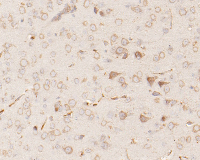 Immunohistochemical analysis of paraffin-embedded mouse brain tissue using anti-RARS antibody. The section was pre-treated using heat mediated antigen retrieval with Tris-EDTA buffer (pH 8.0-8.4) for 20 minutes.The tissues were blocked in 5% BSA for 30 minutes at room temperature, washed with ddH2O and PBS, and then probed with the primary antibody (HA500027, 1/800) for 30 minutes at room temperature. The detection was performed using an HRP conjugated compact polymer system. DAB was used as the chromogen. Tissues were counterstained with hematoxylin and mounted with DPX.