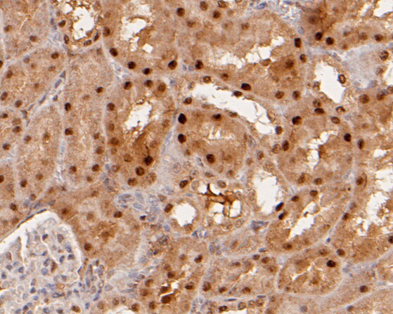 Immunohistochemical analysis of paraffin-embedded rat kidney tissue using anti-MAT2A antibody. The section was pre-treated using heat mediated antigen retrieval with sodium citrate buffer (pH 6.0) for 20 minutes. The tissues were blocked in 5% BSA for 30 minutes at room temperature, washed with ddH2O and PBS, and then probed with the primary antibody (HA500028, 1/800)  for 30 minutes at room temperature. The detection was performed using an HRP conjugated compact polymer system. DAB was used as the chromogen. Tissues were counterstained with hematoxylin and mounted with DPX.
