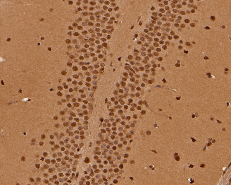 Immunohistochemical analysis of paraffin-embedded mouse brain tissue using anti-MAT2A antibody. The section was pre-treated using heat mediated antigen retrieval with sodium citrate buffer (pH 6.0) for 20 minutes. The tissues were blocked in 5% BSA for 30 minutes at room temperature, washed with ddH2O and PBS, and then probed with the primary antibody (HA500028, 1/200)  for 30 minutes at room temperature. The detection was performed using an HRP conjugated compact polymer system. DAB was used as the chromogen. Tissues were counterstained with hematoxylin and mounted with DPX.