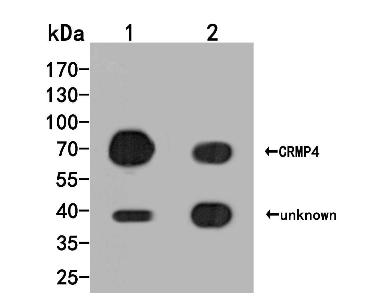 Western blot analysis of CRMP4 on different lysates. Proteins were transferred to a PVDF membrane and blocked with 5% BSA in PBS for 1 hour at room temperature. The primary antibody (HA500030, 1/500) was used in 5% BSA at room temperature for 2 hours. Goat Anti-Rabbit IgG - HRP Secondary Antibody (HA1001) at 1:5,000 dilution was used for 1 hour at room temperature.<br />
Positive control: <br />
Lane 1: Rat spinal cord tissue lysate<br />
Lane 2: LO2 cell lysate