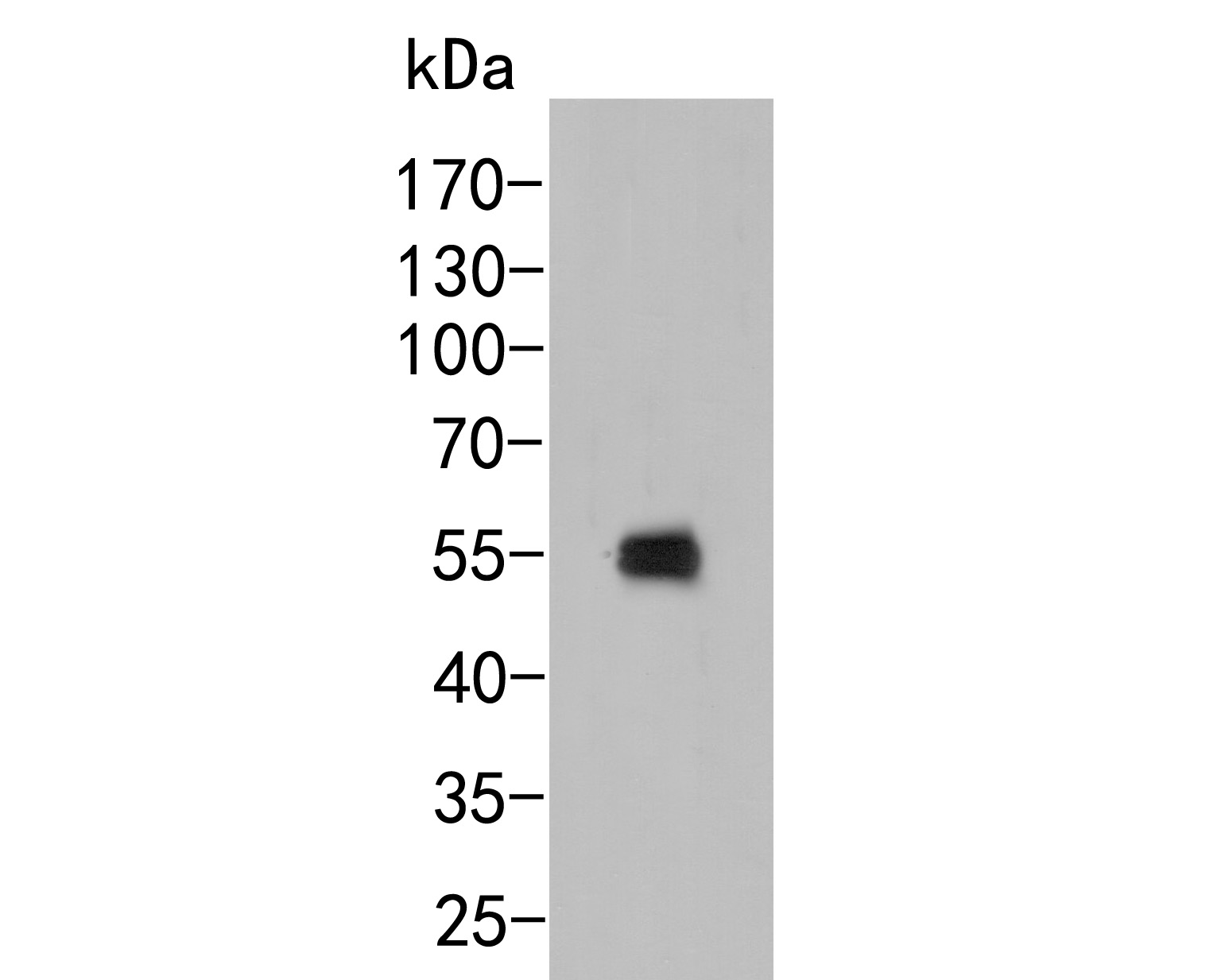 Western blot analysis of MST1 on mouse bone marrow tissue lysates. Proteins were transferred to a PVDF membrane and blocked with 5% BSA in PBS for 1 hour at room temperature. The primary antibody (HA500031, 1/500) was used in 5% BSA at room temperature for 2 hours. Goat Anti-Rabbit IgG - HRP Secondary Antibody (HA1001) at 1:5,000 dilution was used for 1 hour at room temperature.