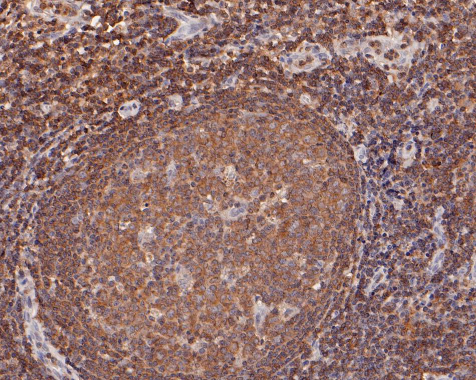 Immunohistochemical analysis of paraffin-embedded human tonsil  tissue using anti-MST1 antibody. The section was pre-treated using heat mediated antigen retrieval with sodium citrate buffer (pH 6.0) for 20 minutes. The tissues were blocked in 5% BSA for 30 minutes at room temperature, washed with ddH2O and PBS, and then probed with the primary antibody (HA500031, 1/500)  for 30 minutes at room temperature. The detection was performed using an HRP conjugated compact polymer system. DAB was used as the chromogen. Tissues were counterstained with hematoxylin and mounted with DPX.
