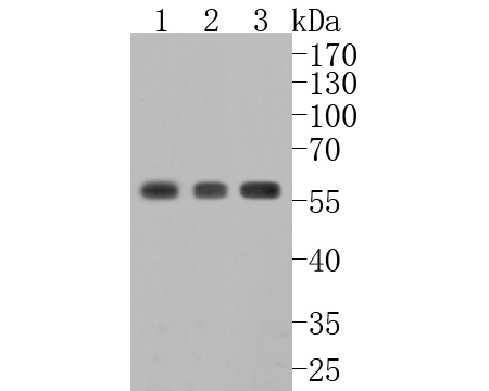 Western blot analysis of NLK on different lysates. Proteins were transferred to a PVDF membrane and blocked with 5% BSA in PBS for 1 hour at room temperature. The primary antibody (HA500033, 1/500) was used in 5% BSA at room temperature for 2 hours. Goat Anti-Rabbit IgG - HRP Secondary Antibody (HA1001) at 1:5,000 dilution was used for 1 hour at room temperature.<br />
Positive control: <br />
Lane 1: SW480 cell lysate<br />
Lane 2: HCT116 cell lysate<br />
Lane 3: C2C12 cell lysate