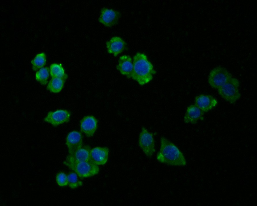 ICC staining of NLK in SW620 cells (green). Formalin fixed cells were permeabilized with 0.1% Triton X-100 in TBS for 10 minutes at room temperature and blocked with 1% Blocker BSA for 15 minutes at room temperature. Cells were probed with the primary antibody (HA500033, 1/50) for 1 hour at room temperature, washed with PBS. Alexa Fluor®488 Goat anti-Rabbit IgG was used as the secondary antibody at 1/1,000 dilution. The nuclear counter stain is DAPI (blue).