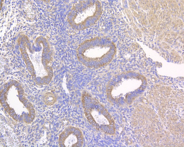 Immunohistochemical analysis of paraffin-embedded human uterus tissue using anti-NLK antibody. The section was pre-treated using heat mediated antigen retrieval with Tris-EDTA buffer (pH 8.0-8.4) for 20 minutes.The tissues were blocked in 5% BSA for 30 minutes at room temperature, washed with ddH2O and PBS, and then probed with the primary antibody (HA500033, 1/200) for 30 minutes at room temperature. The detection was performed using an HRP conjugated compact polymer system. DAB was used as the chromogen. Tissues were counterstained with hematoxylin and mounted with DPX.
