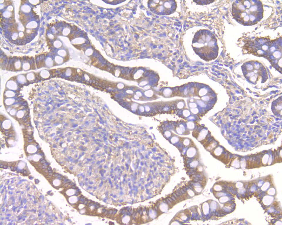 Immunohistochemical analysis of paraffin-embedded human small intestine tissue using anti-NLK antibody. The section was pre-treated using heat mediated antigen retrieval with Tris-EDTA buffer (pH 8.0-8.4) for 20 minutes.The tissues were blocked in 5% BSA for 30 minutes at room temperature, washed with ddH2O and PBS, and then probed with the primary antibody (HA500033, 1/200) for 30 minutes at room temperature. The detection was performed using an HRP conjugated compact polymer system. DAB was used as the chromogen. Tissues were counterstained with hematoxylin and mounted with DPX.