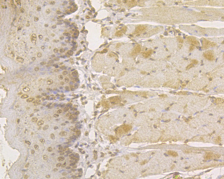 Immunohistochemical analysis of paraffin-embedded rat tongue tissue using anti-Plakophilin 3 antibody. The section was pre-treated using heat mediated antigen retrieval with sodium citrate buffer (pH 6.0) for 20 minutes. The tissues were blocked in 5% BSA for 30 minutes at room temperature, washed with ddH2O and PBS, and then probed with the primary antibody (HA500034, 1/1,500)  for 30 minutes at room temperature. The detection was performed using an HRP conjugated compact polymer system. DAB was used as the chromogen. Tissues were counterstained with hematoxylin and mounted with DPX.