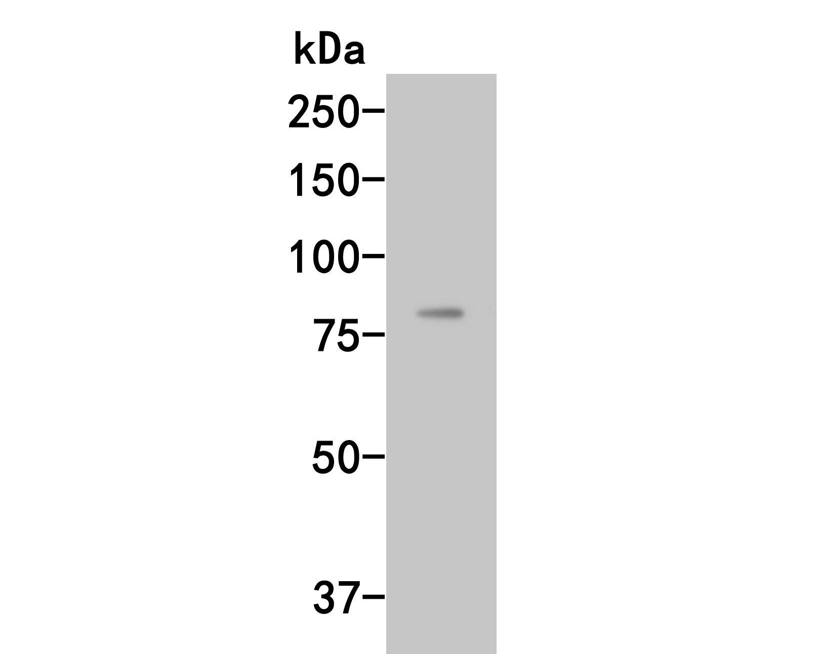 Western blot analysis of Complement factor B on rat liver tissue lysates. Proteins were transferred to a PVDF membrane and blocked with 5% BSA in PBS for 1 hour at room temperature. The primary antibody (HA500036, 1/500) was used in 5% BSA at room temperature for 2 hours. Goat Anti-Rabbit IgG - HRP Secondary Antibody (HA1001) at 1:5,000 dilution was used for 1 hour at room temperature.