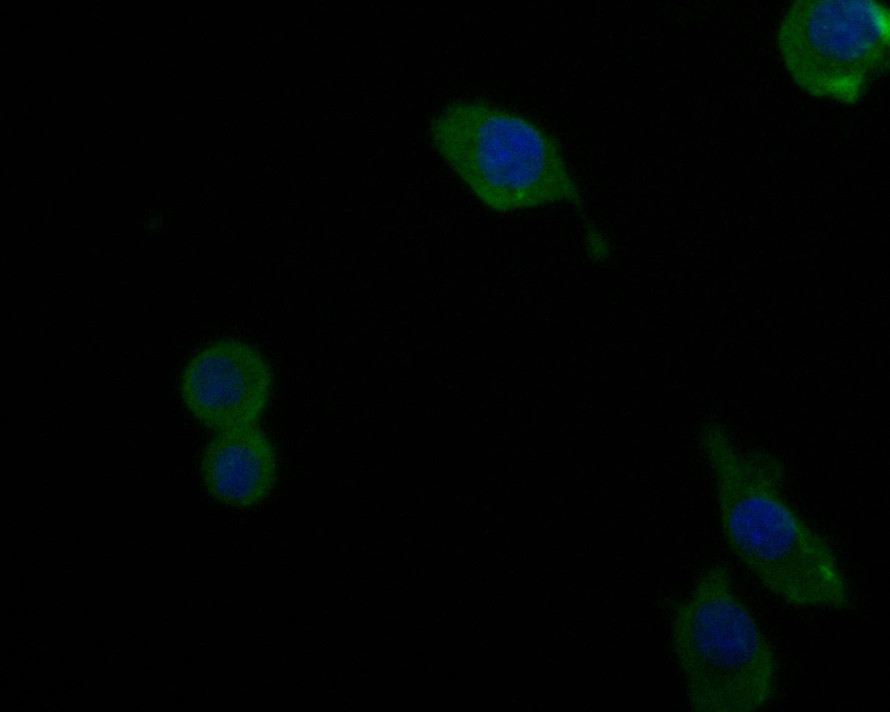 ICC staining of Complement factor B in SKOV-3 cells (green). Formalin fixed cells were permeabilized with 0.1% Triton X-100 in TBS for 10 minutes at room temperature and blocked with 1% Blocker BSA for 15 minutes at room temperature. Cells were probed with the primary antibody (HA500036, 1/200) for 1 hour at room temperature, washed with PBS. Alexa Fluor®488 Goat anti-Rabbit IgG was used as the secondary antibody at 1/1,000 dilution. The nuclear counter stain is DAPI (blue).