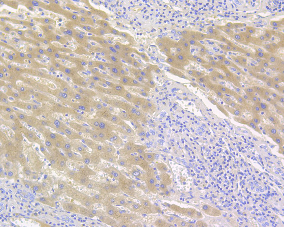 Immunohistochemical analysis of paraffin-embedded human liver tissue using anti-Complement factor B antibody. The section was pre-treated using heat mediated antigen retrieval with Tris-EDTA buffer (pH 8.0-8.4) for 20 minutes.The tissues were blocked in 5% BSA for 30 minutes at room temperature, washed with ddH2O and PBS, and then probed with the primary antibody (HA500036, 1/800) for 30 minutes at room temperature. The detection was performed using an HRP conjugated compact polymer system. DAB was used as the chromogen. Tissues were counterstained with hematoxylin and mounted with DPX.