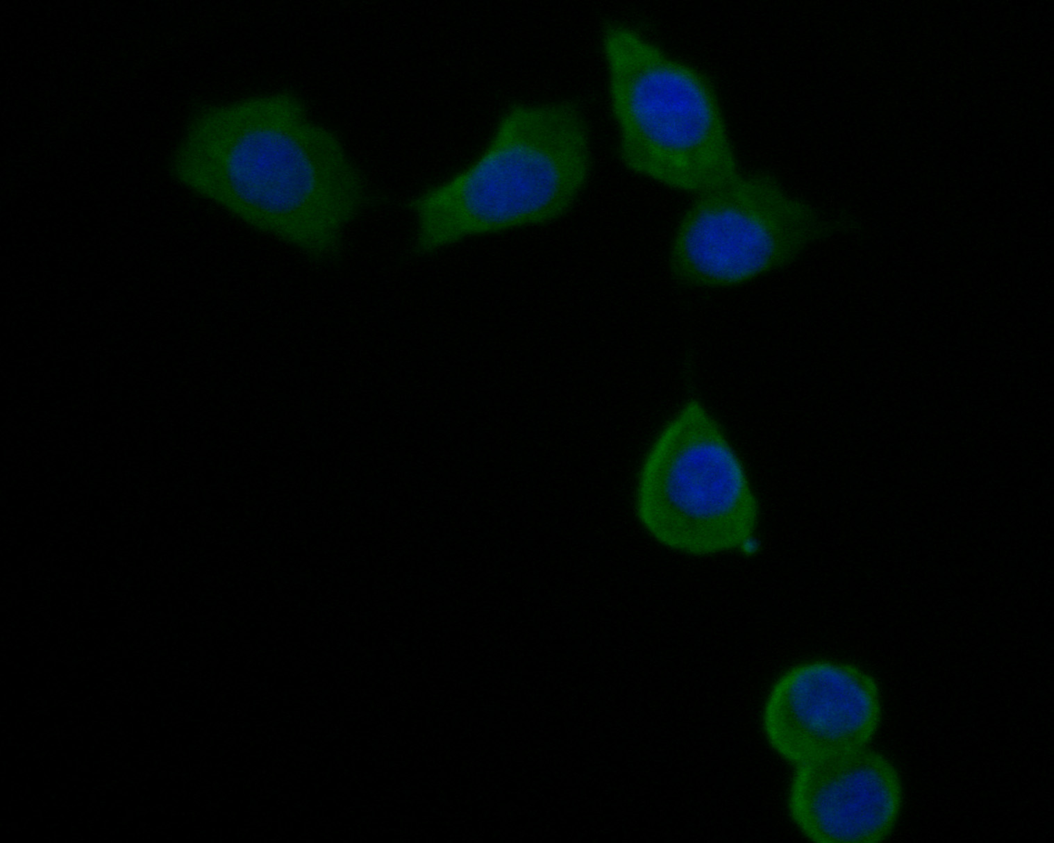 ICC staining of Dynamin 3 in SKOV-3 cells (green). Formalin fixed cells were permeabilized with 0.1% Triton X-100 in TBS for 10 minutes at room temperature and blocked with 1% Blocker BSA for 15 minutes at room temperature. Cells were probed with the primary antibody (HA500037, 1/200) for 1 hour at room temperature, washed with PBS. Alexa Fluor®488 Goat anti-Rabbit IgG was used as the secondary antibody at 1/1,000 dilution. The nuclear counter stain is DAPI (blue).