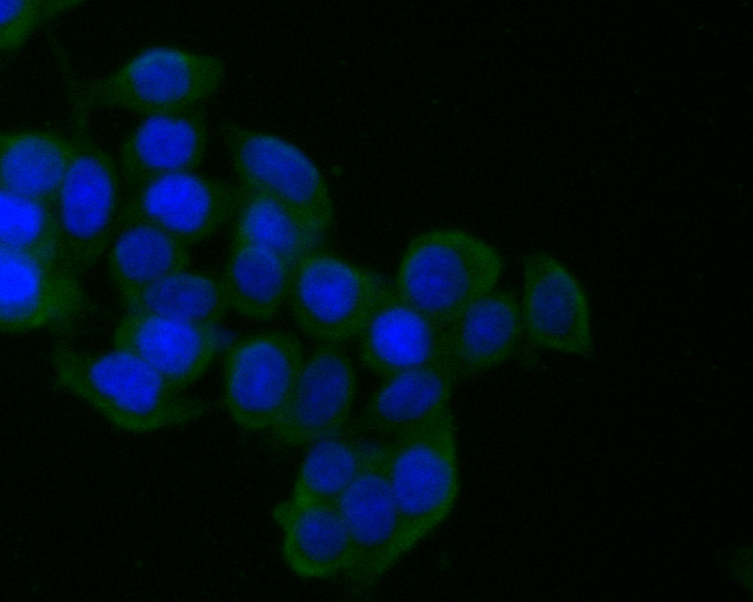 ICC staining of CD21 in SW620 cells (green). Formalin fixed cells were permeabilized with 0.1% Triton X-100 in TBS for 10 minutes at room temperature and blocked with 1% Blocker BSA for 15 minutes at room temperature. Cells were probed with the primary antibody (HA600001, 1/50) for 1 hour at room temperature, washed with PBS. Alexa Fluor®488 Goat anti-Mouse IgG was used as the secondary antibody at 1/1,000 dilution. The nuclear counter stain is DAPI (blue).