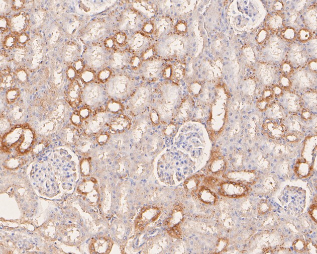 Immunohistochemical analysis of paraffin-embedded rat kidney tissue using anti-SLC27A4 antibody. The section was pre-treated using heat mediated antigen retrieval with Tris-EDTA buffer (pH 8.0-8.4) for 20 minutes.The tissues were blocked in 5% BSA for 30 minutes at room temperature, washed with ddH2O and PBS, and then probed with the primary antibody (HA720001, 1/50) for 30 minutes at room temperature. The detection was performed using an HRP conjugated compact polymer system. DAB was used as the chromogen. Tissues were counterstained with hematoxylin and mounted with DPX.