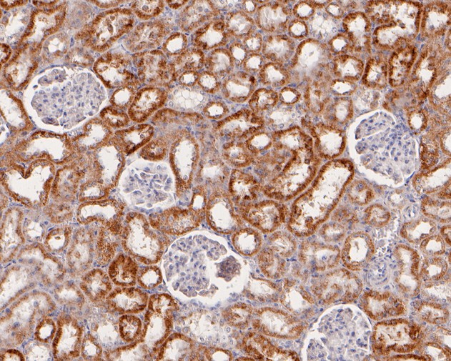 Immunohistochemical analysis of paraffin-embedded human liver tissue using anti-ACAA2 antibody. The section was pre-treated using heat mediated antigen retrieval with Tris-EDTA buffer (pH 8.0-8.4) for 20 minutes.The tissues were blocked in 5% BSA for 30 minutes at room temperature, washed with ddH2O and PBS, and then probed with the primary antibody (HA720006, 1/200) for 30 minutes at room temperature. The detection was performed using an HRP conjugated compact polymer system. DAB was used as the chromogen. Tissues were counterstained with hematoxylin and mounted with DPX.