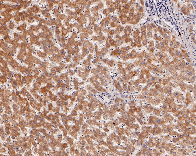 Immunohistochemical analysis of paraffin-embedded human appendix tissue using anti-ACAA2 antibody. The section was pre-treated using heat mediated antigen retrieval with Tris-EDTA buffer (pH 8.0-8.4) for 20 minutes.The tissues were blocked in 5% BSA for 30 minutes at room temperature, washed with ddH2O and PBS, and then probed with the primary antibody (HA720006, 1/50) for 30 minutes at room temperature. The detection was performed using an HRP conjugated compact polymer system. DAB was used as the chromogen. Tissues were counterstained with hematoxylin and mounted with DPX.
